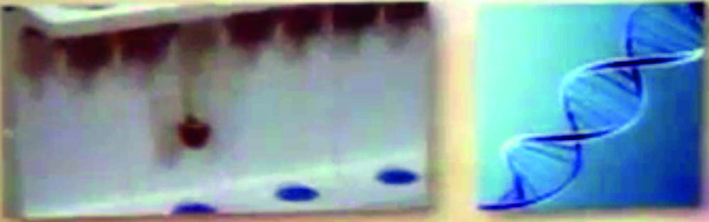 the Eucharistic Miracle of Tixtla. Ciano in 700 AD. When there is the presence of human DNA one thinks that also the genetic profile can be automatically obtained. Interestingly in all the studies performed on the images that sweated blood or in the consecrated Hosts