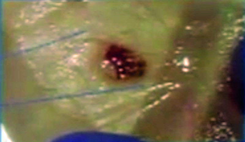 channels and the rest remaining on the surface without being absorbed. By analyzing the Host it was observed that it was human blood of type AB and that it corresponded to tissue. Then an analysis was done of phyto-
