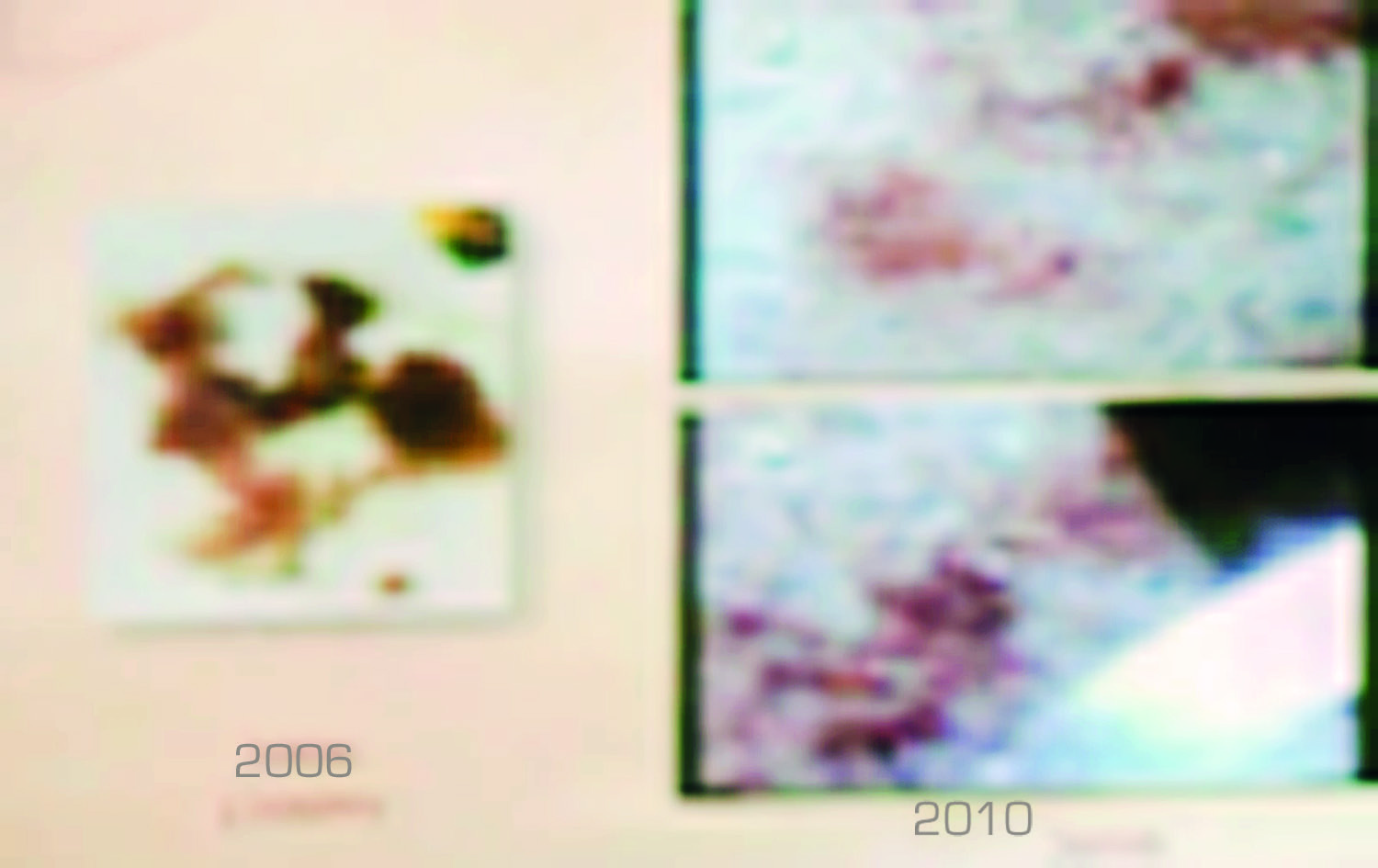 In 2010, by means of a study of digital microscopic penetration through the shooting of ultraviolet rays and intense white light it was demon-