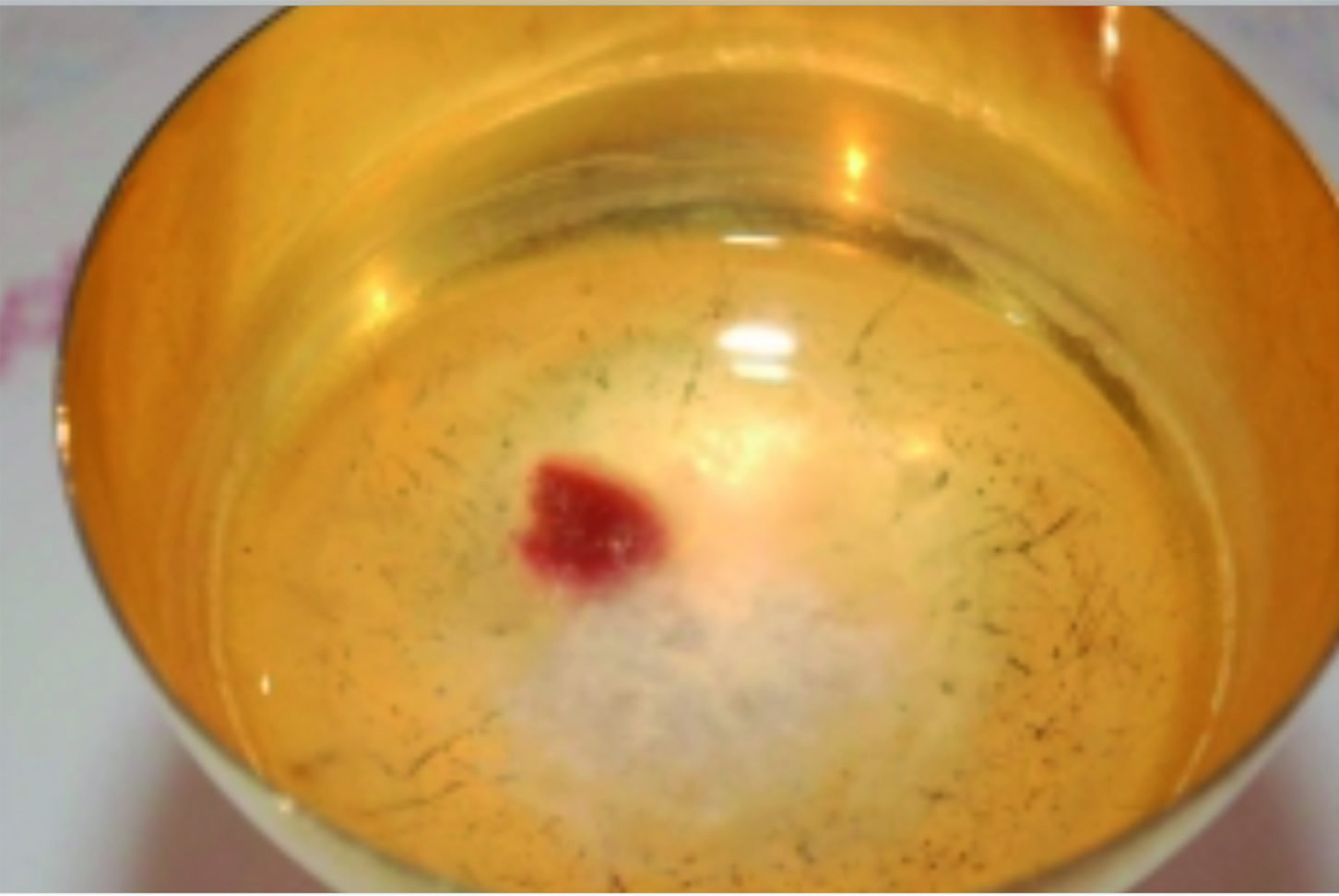 On January 5, 2014, the priests noticed a stain on the Host, which was immersed in the water. Similar to a bloodstain. The Bishop of Legnica, Monsignor Stefan Cichy, was